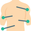 acupuncture